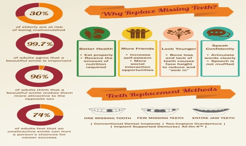 Overdenture | Grand Central Dentistry