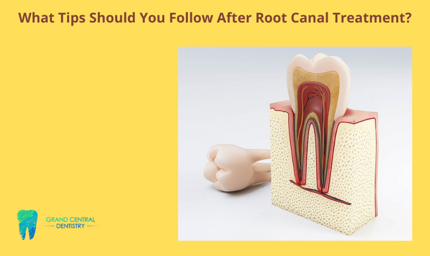 Root canal treatment in Conroe