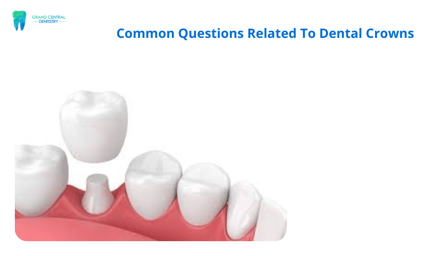 dental crowns in Conroe