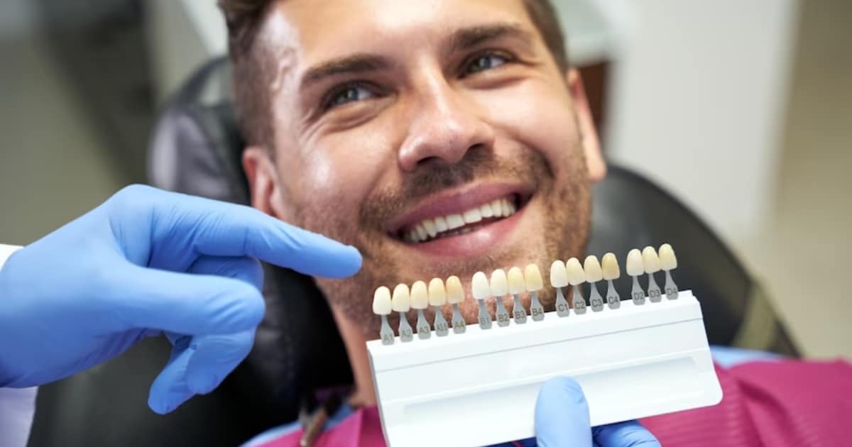 How Long Do Porcelain Veneers Last Durability and Longevity
