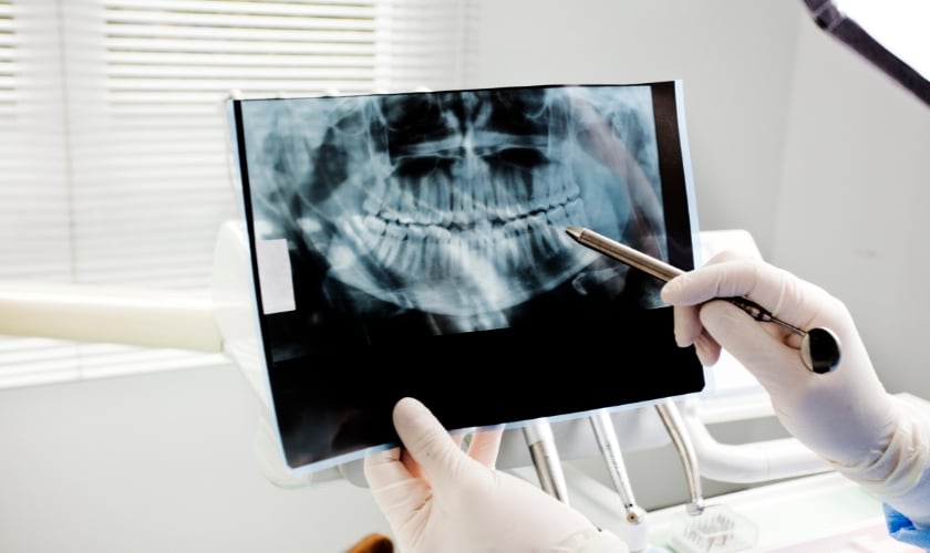 the importance of oral cancer screenings